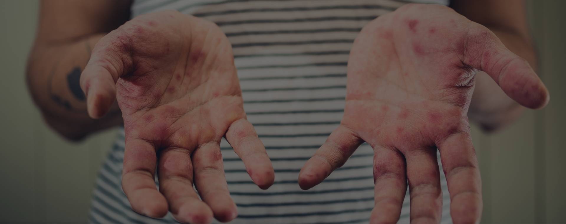 Infectious Disease Cleanup Near Me